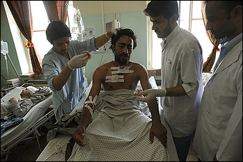 Hamid Agha receives medical attention from doctors at Wazir Akbar Khan Hospital after he was injured when a car bomb exploded in front of the NATO headquarters, in Kabul, Afghanistan, on Saturday, August 15, 2009.